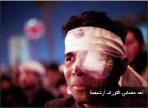إجراء 100 عملية للعين لأبناء الشرقية بمناسبة احتفالات ثورة يناير 1 مصاب