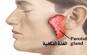 الغده الغده