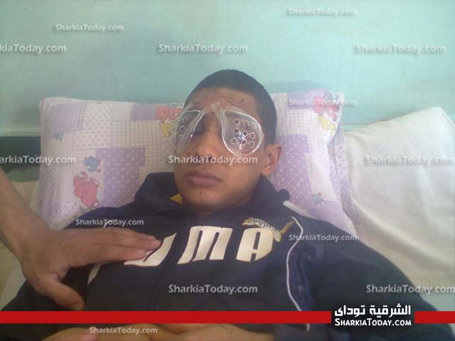 وقفه للصم بالزقازيق للمطالبه بعلاج أحد ضحايا "البلطجه" علي نفقة الدوله 3 22