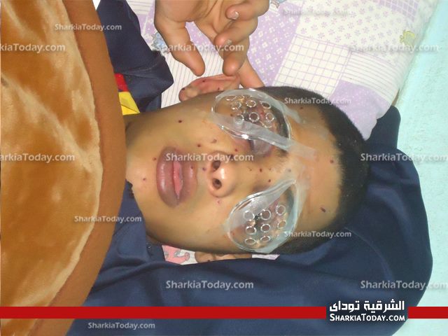 بالصور| وقفة تطالب بعلاج أحد ضحايا البلطجه بالزقازيق علي نفقة الدوله 1 2