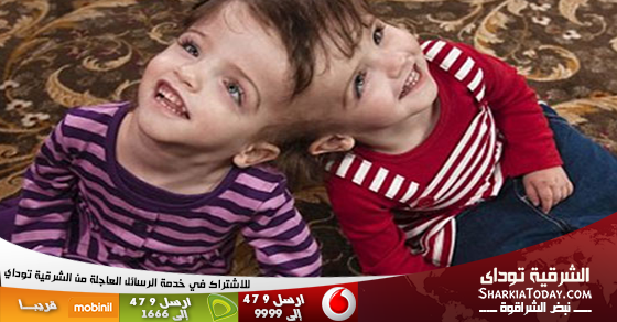 توأمتان تعيشان بجسدين ودماغ واحد