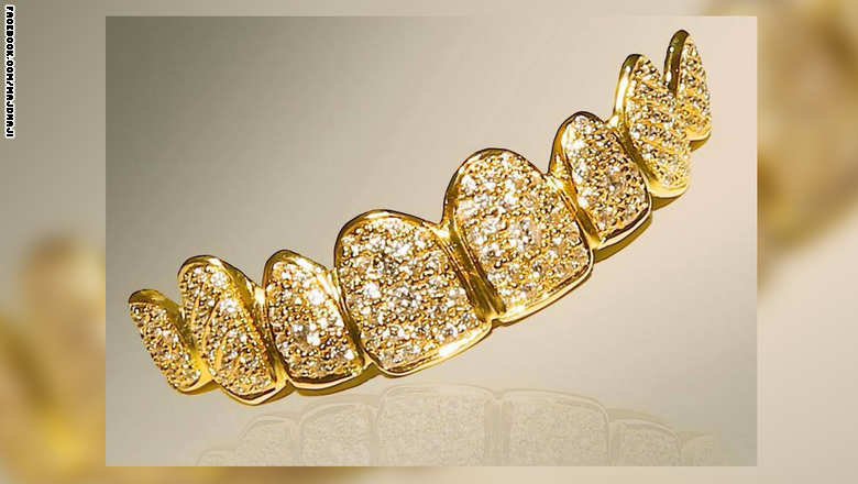 قطرية تدخل «غينيس» بأغلى ابتسامة من الذهب والألماس 30 newteeth1