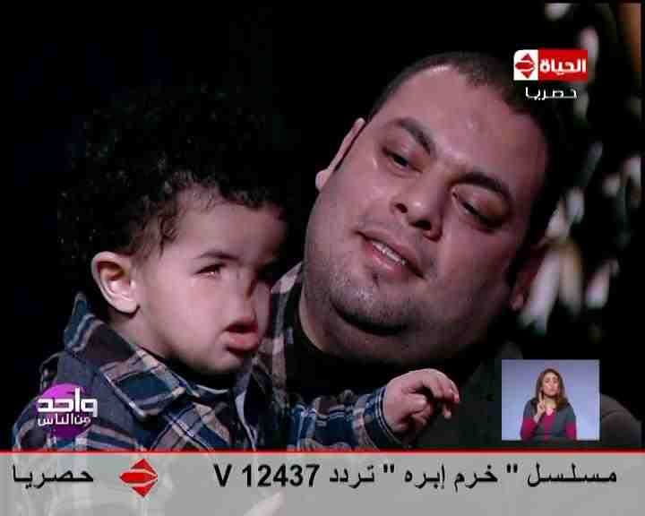 بالفيديو و الصور : طفل يولد بلا أنف وبلا أعين وبلا أسنان ومريض بثقب بالقلب 2 طفل يولد بلا أنف وبلا أعين وبلا أسنان ومريض بثقب بالقلب (1)