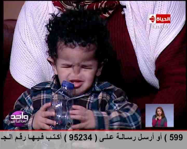 بالفيديو و الصور : طفل يولد بلا أنف وبلا أعين وبلا أسنان ومريض بثقب بالقلب 4 طفل يولد بلا أنف وبلا أعين وبلا أسنان ومريض بثقب بالقلب (3)