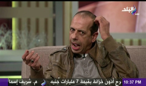 بالفيديو .. محمد الصاوي يحذر من وصفة أفقدته شعر رأسه 1 265