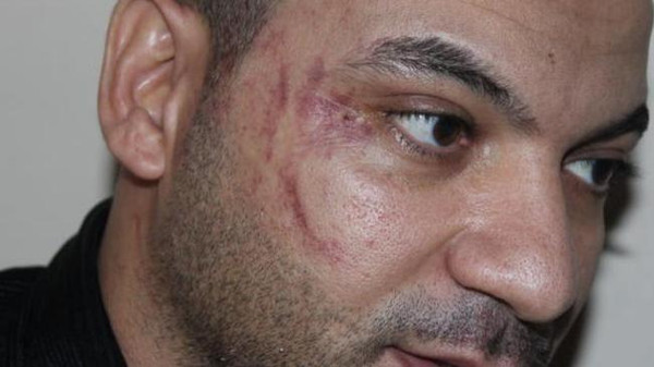 سفيرنا بالأردن: اتصلت بالعامل المصرى المعتدى عليه وأكدت له وقوفنا بجانبه 1 5aae0bd5-4e72-41e9-b401-3a4859502a42_16x9_600x338