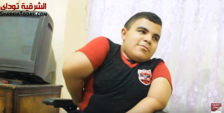 شاهد.. الطفل «إبراهيم» يعاني من مرض العظم الزجاجي وحلمه كرسي متحرك بموتور 3 الطفل ابراهيم يعانى من مرض الزجاجي ببلبيس