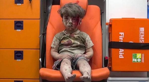 أول تعليق من بشار الأسد على صورة الطفل “عمران”
