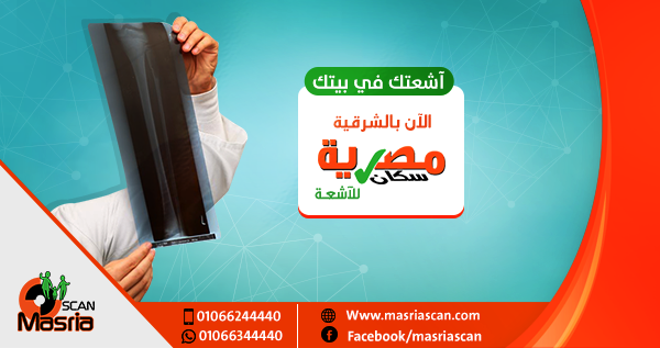 مصرية سكان للأشعة بالشرقية تقدم خدمة «أشعتك في بيتك» 1