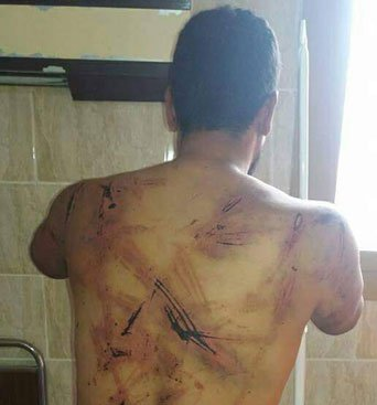 حبس المتهمين بخطف حلاق الشرقية وتعذيبه ومحاولة هتك عرضه 4 أيام 1