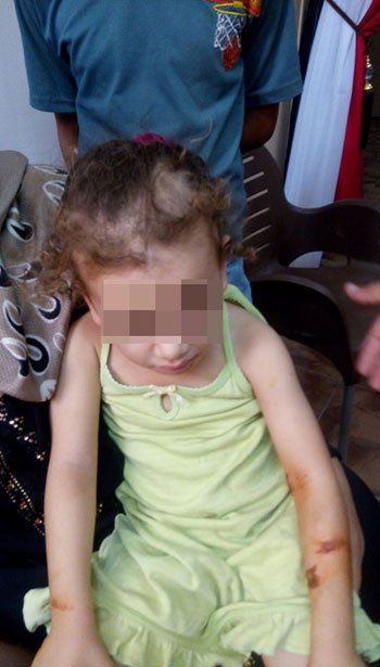 الطفلة ريماس