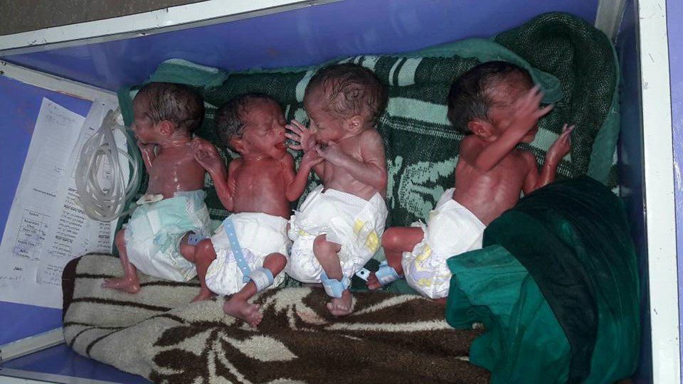 بالصور.. سيدة قناوية تضع 4 توائم.. والأطباء يلتقطون سيلفي مع الأطفال 3 بالصور.. سيدة قناوية تضع 4 توائم.. والأطباء يلتقطون سيلفى مع الأطفال 2