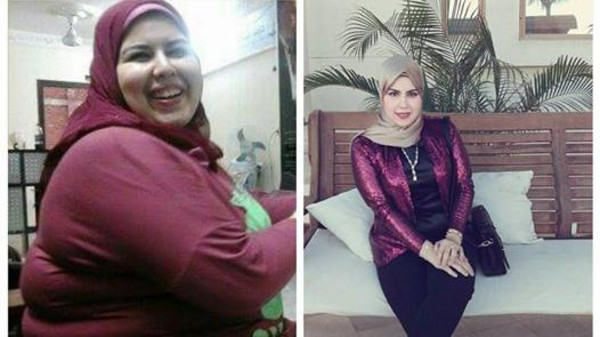 فتاة من الزقازيق تخسر نصف وزنها لتتجنب المضايقات 1 فتاة من الزقازيق تخسر نصف وزنها لتتجنب المضايقات