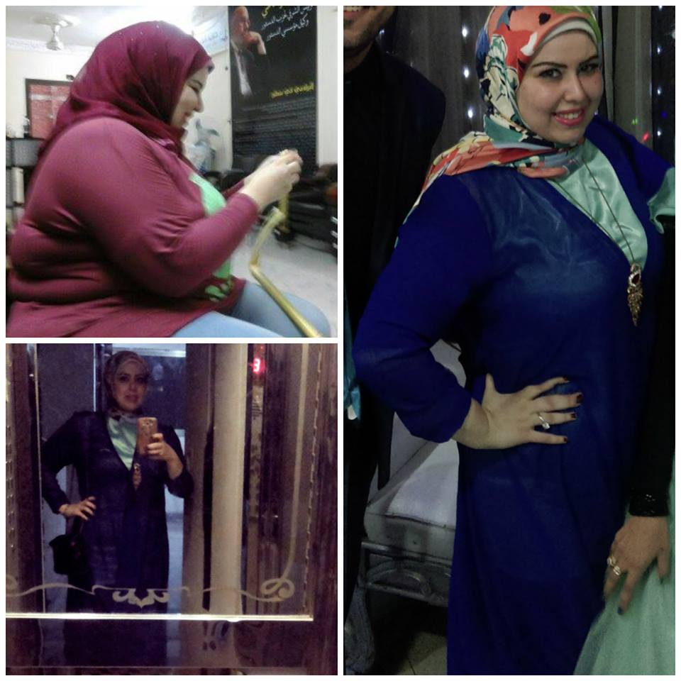 فتاة من الزقازيق تخسر نصف وزنها لتتجنب المضايقات 2 فتاة من الزقازيق تخسر نصف وزنها لتتجنب المضايقات2