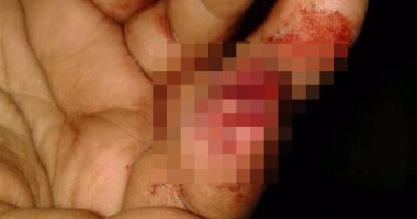 الأهالى يسلمون السيدة المتهمتة بقطع عقلة إصبع جارتها بأسنانها للشرطة بالشرقية