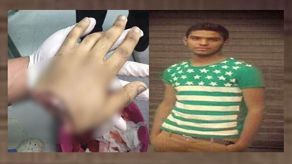 4 أشقاء يقطعون يد جارهم علنًا بعد اتهامه بسرقة هاتفهم