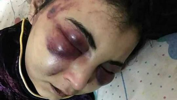قصة السيدة المصرية التى عذبها زوجها لمدة 3 أيام متتالية .. لهذا السبب 9 قصة السيدة المصرية التى عذبها زوجها لمدة 3 أيام متتالية .. لهذا السبب