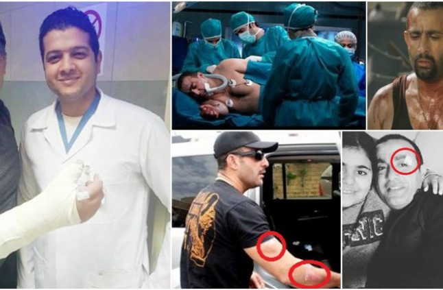10 أعمال فنية جعلت «السقا» ملك «الإصابات».. كاد يفقد بصره بسبب أحدها
