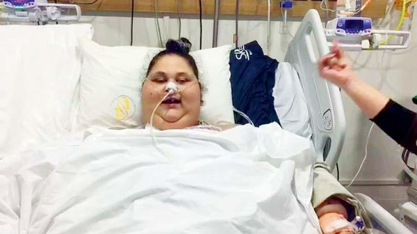 الطبيب الهندي المعالج لإيمان يكشف حقائق صادمة عن شقيقتها : كذبت علينا 14 الطيبب