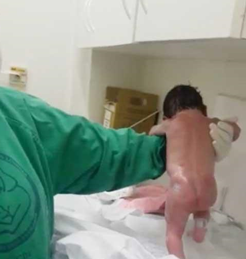 بالفيديو.. لأول مرة طفل يمشى بعد ولادته بدقائق 2 بالفيديو.. لأول مرة طفل يمشى بعد ولادته بدقائق