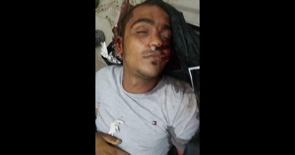 العثور على جثة شاب توفي إثر إصطدامه بسيارة بالطريق العام ببلبيس 1 العثور على جثة شاب توفي إثر إصطدامه بسيارة بالطريق العام ببلبيس