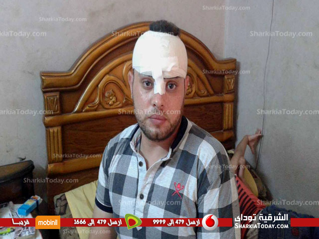 أحد الناجيين من حادث قطار الإسكندرية يروي تفاصيل اللحظات الأخيرة قبل الحادث 1 أحد الناجيين من حادث قطار الإسكندرية يروي تفاصيل اللحظات الأخيرة قبل الحادث