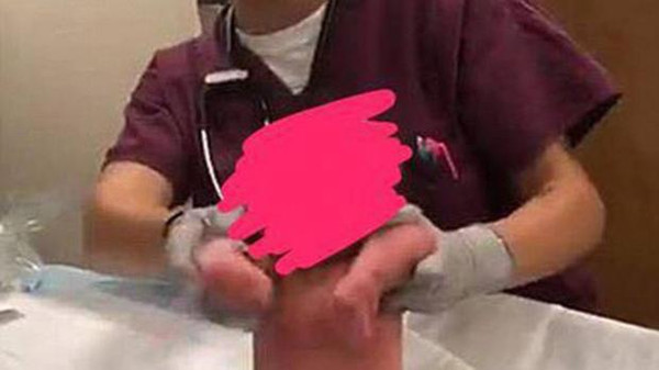 صورة لطفل أثناء الولادة تتسبب في فصل موظفين بمستشفى 1 %D8%B5%D9%88%D8%B1%D8%A9 %D9%84%D8%B7%D9%81%D9%84 %D8%A3%D8%AB%D9%86%D8%A7%D8%A1 %D8%A7%D9%84%D9%88%D9%84%D8%A7%D8%AF%D8%A9 %D8%AA%D8%AA%D8%B3%D8%A8%D8%A8 %D9%81%D9%8A %D9%81%D8%B5%D9%84 %D9%85%D9%88%D8%B8%D9%81%D9%8A%D9%86 %D8%A8%D9%85%D8%B3%D8%AA%D8%B4%D9%81%D9%89
