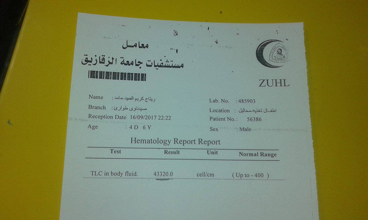 مأساة الطفلة «ريتاج» ابنة أبوكبير فقدت البصر والنطق بسبب الإهمال الطبي 3 مأساة الطفلة ريتاج.. فقدت البصر والنطق بسبب غياب ضمير الطبيب 2