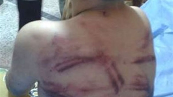 والد الطفل ضحية تعذيب أمه يفجر مفاجأة عن الحادث 1 والد الطفل ضحية تعذيب أمه يفجر مفاجأة عن الحادث