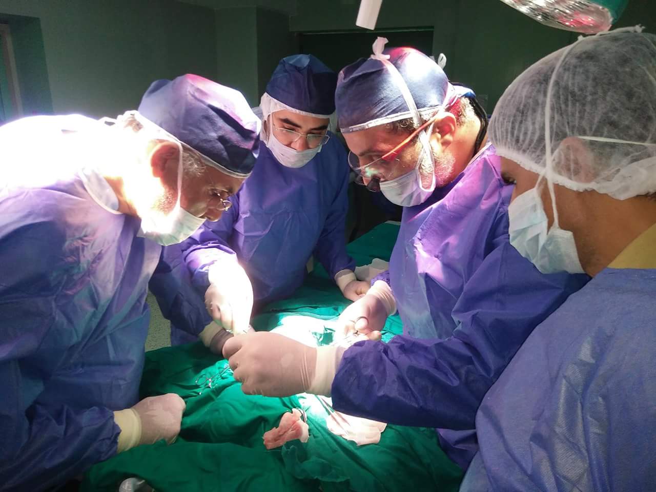 طبي بالشرقية ينجح في إجراء عملية تجميلية لرضيع أكلت أمه شفاه 2