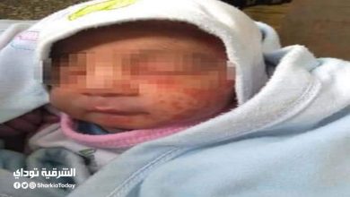 النمل يأكل وجه طفل حديث الولادة عٌثر عليه أمام مسجد بالشرقية 8 النمل يأكل وجه طفل حديث الولادة بعد إلقاؤه بجوار مسجد بالحسينية