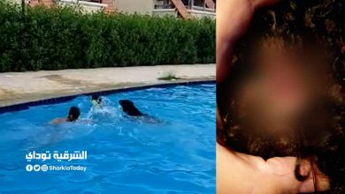 "فيديو مؤلم".. كلب شرس يهاجم طفل في حمام سباحة داخل إحدى قرى الساحل الشمالي 13 كلب شرس يهاجم طفل