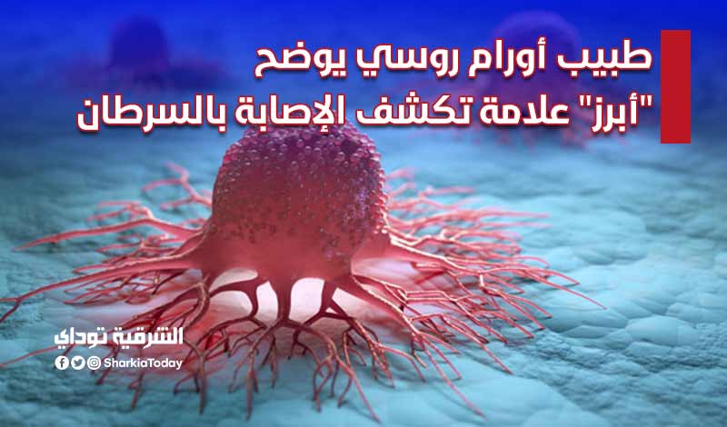 طبيب أورام روسي يوضح "أبرز" علامة تكشف الإصابة بالسرطان.. انتبه لها لأنها غير متوقعة 1 علامة تكشف الإصابة بالسرطان