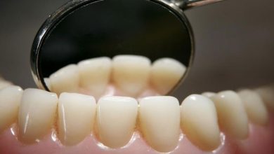 روشتة علاج نزيف اللثة