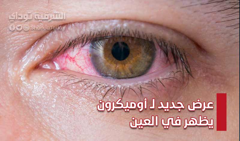 "خفايا وأعراض المتحور لا تنتهي".. طبيبة بريطانية تكشف عرض جديد لـ أوميكرون يظهر في العين 3 عرض جديد لـ أوميكرون يظهر في العين