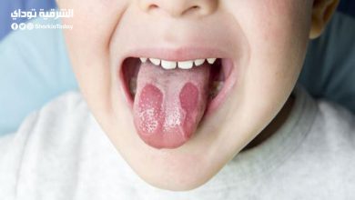 هذه المصاصة تحرق لسان ابنك