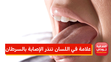 علامة في اللسان تنذر الإصابة بالسرطان 7 علامة في اللسان تنذر الإصابة بالسرطان