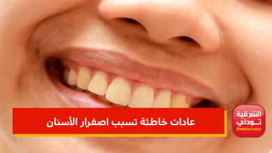 عادات خاطئة تسبب اصفرار الأسنان