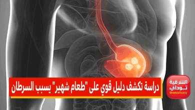 دراسة تكشف دليل قوي على طعام شهير يسبب السرطان 6 سرطان المعدة 1