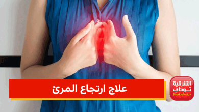 علاج ارتجاع المرئ