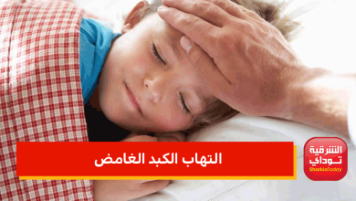 بعد وفاة أول حالة بالتهاب الكبد الغامض.. الصحة تكشف حقيقة علاقته بكورونا 5 التهاب الكبد الغامض