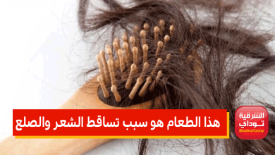 تساقط الشعر8