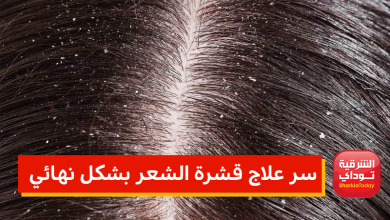 قشرة الراس1