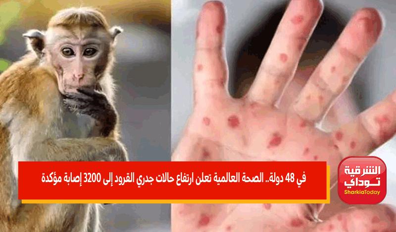  ارتفاع حالات جدري القرود