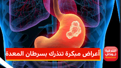أعراض مبكرة تنذرك بسرطان المعدة