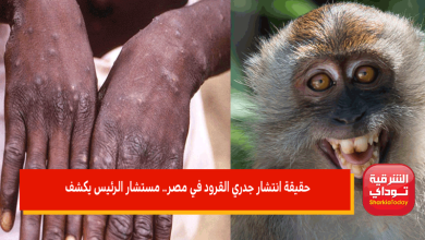 حقيقة انتشار جدري القرود في مصر.. مستشار الرئيس يكشف 4 حقيقة انتشار جدري القرود في مصر