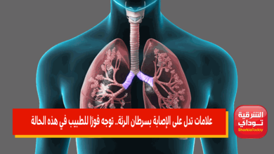 علامات تدل على الإصابة بسرطان الرئة